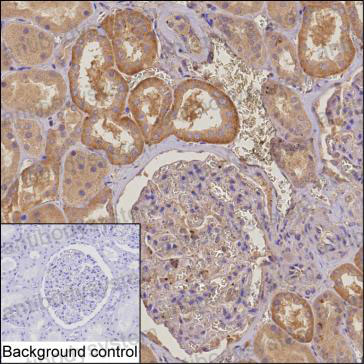 Валидация AntibodySystem RHK70801