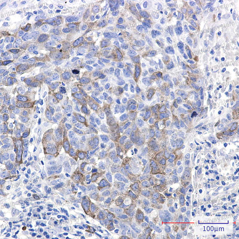 Валидация AntibodySystem RHE93201