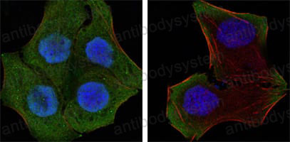 Валидация IF - AntibodySystem RHF36202