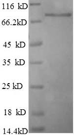 SDS-PAGE