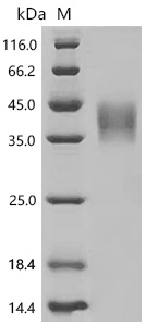 SDS-PAGE