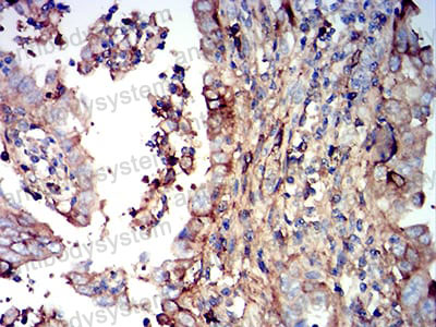 Валидация AntibodySystem RHJ93204