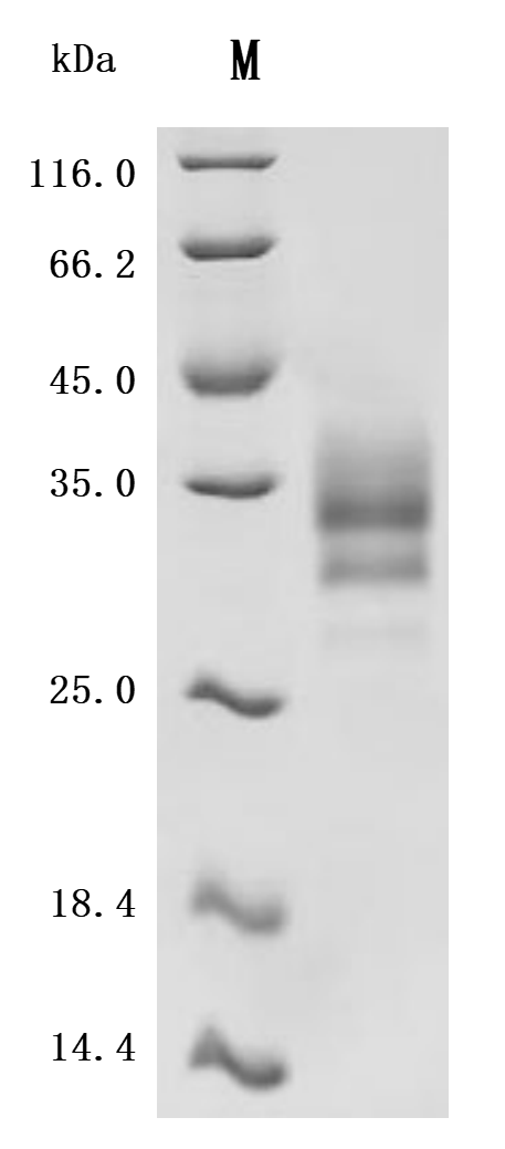 SDS-PAGE