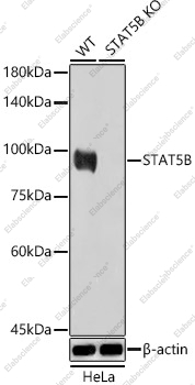 Вестерн-блоттинг, STAT5B, клетки HeLa