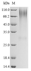 SDS-PAGE