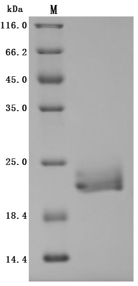 SDS-PAGE