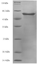 SDS-PAGE
