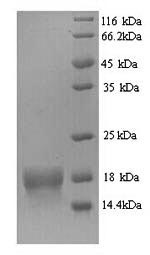 SDS-PAGE