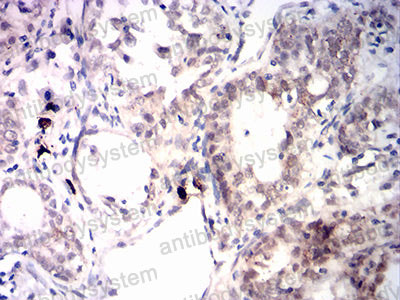 Валидация AntibodySystem RHA11403