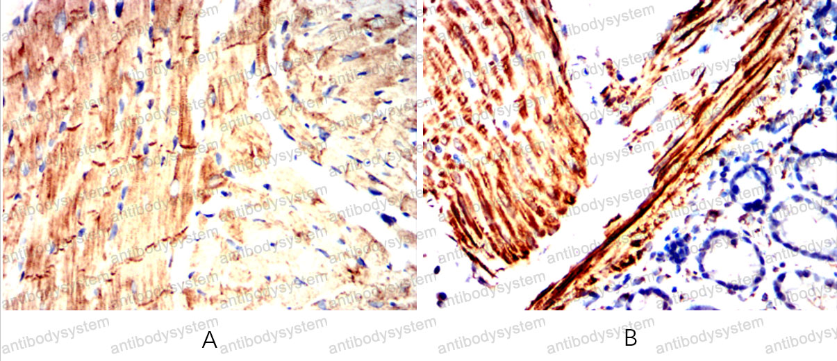 Валидация AntibodySystem RHD25502 (1428)