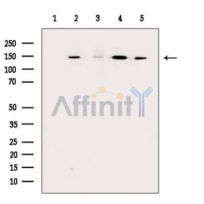 Валидация Affinity DF13635 - 9176