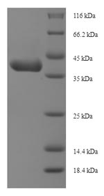 SDS-PAGE
