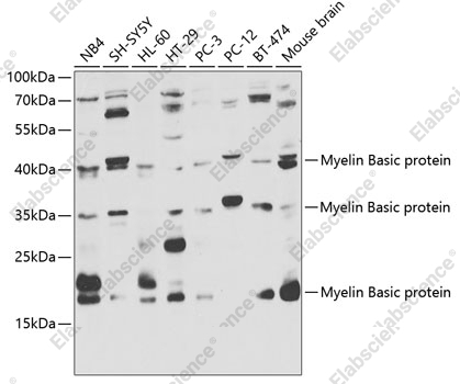 Вестерн-блоттинг, Myelin Basic protein, различные клеточные линии