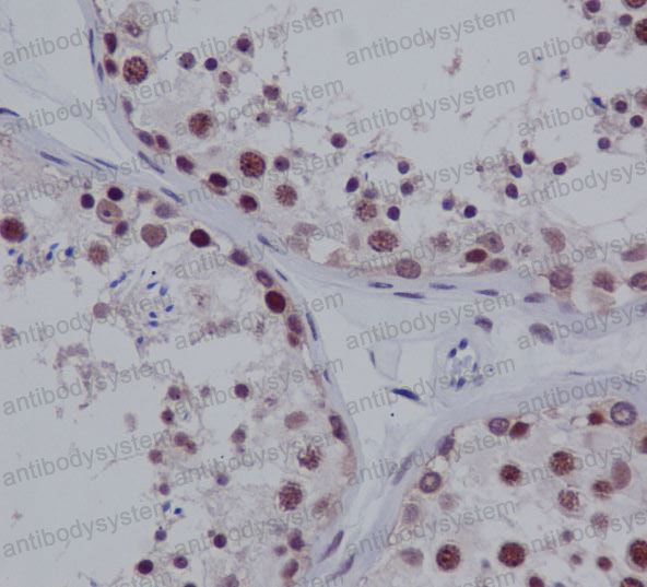 Валидация AntibodySystem RHB35802