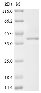 SDS-PAGE
