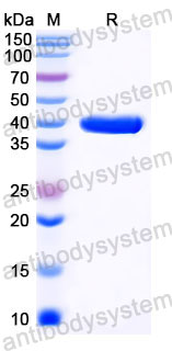 Валидация SDS-PAGE - AntibodySystem RWK08401