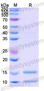 Валидация SDS-PAGE - AntibodySystem DHD61001