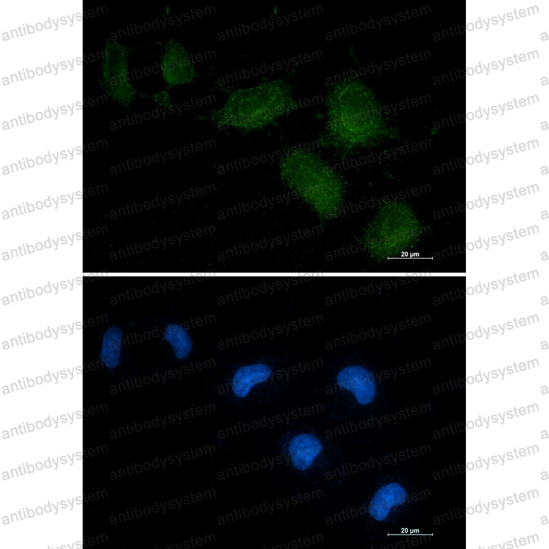 Валидация IF - AntibodySystem RHC01601