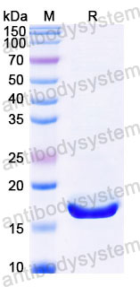 YHC71502, SDS-PAGE