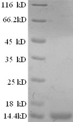SDS-PAGE
