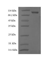 SDS-PAGE