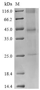 SDS-PAGE