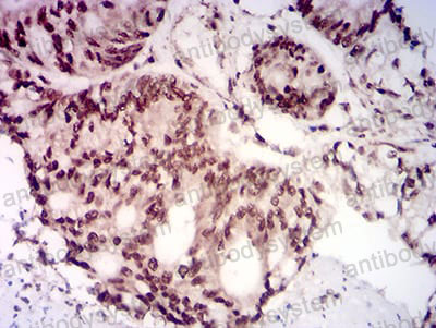 Валидация AntibodySystem RHN89403 (3927)