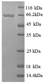 SDS-PAGE