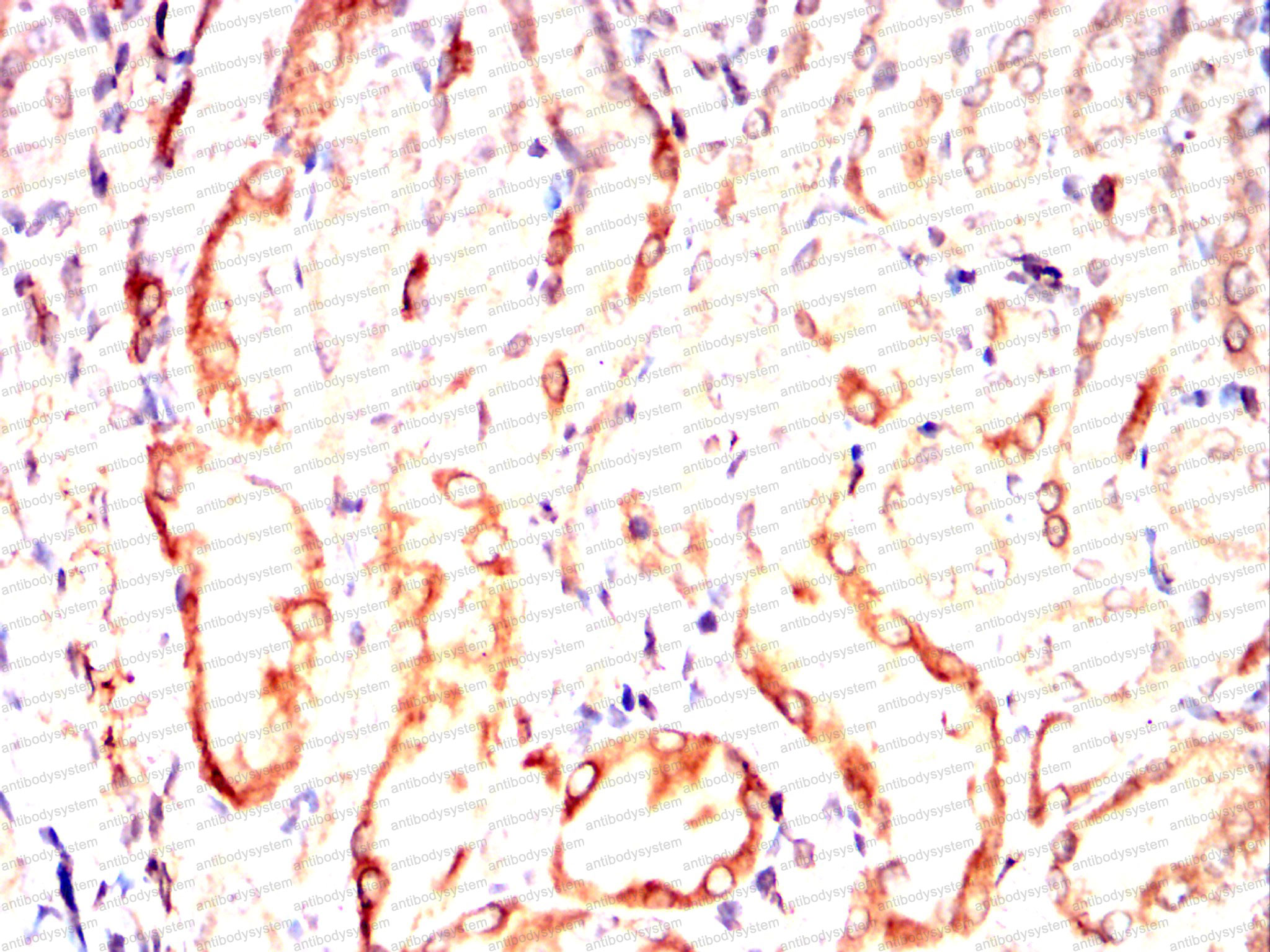 Валидация AntibodySystem RHC97803