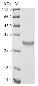 SDS-PAGE
