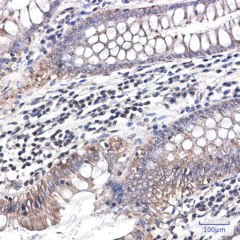 Валидация AntibodySystem RHB20301