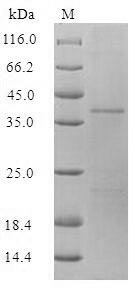 SDS-PAGE