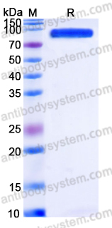 EHK90301, SDS-PAGE