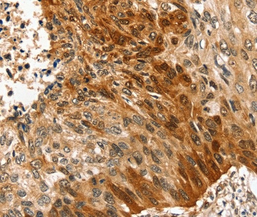 Валидация Elabscience E-AB-16895