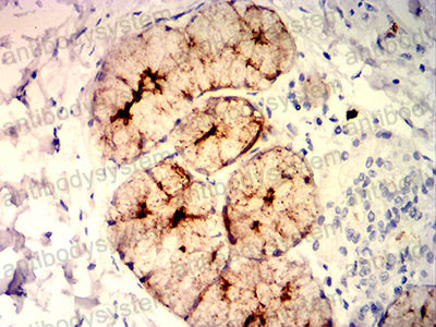 Валидация AntibodySystem RHE25604 (2052)