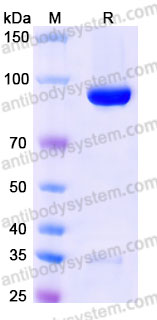AWD30402, SDS-PAGE