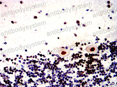 Валидация AntibodySystem RHN99001
