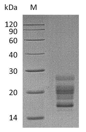 SDS-PAGE