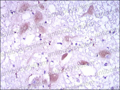 Валидация AntibodySystem RHJ73202 (3535)