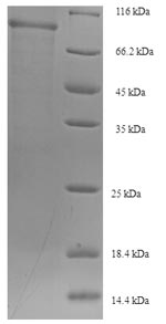 SDS-PAGE