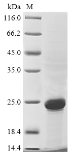 SDS-PAGE