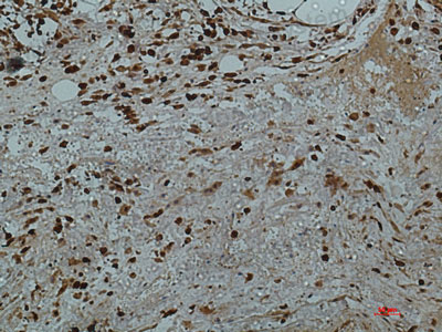 Валидация AntibodySystem RHD27110