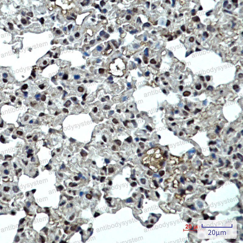 Валидация AntibodySystem RME48201