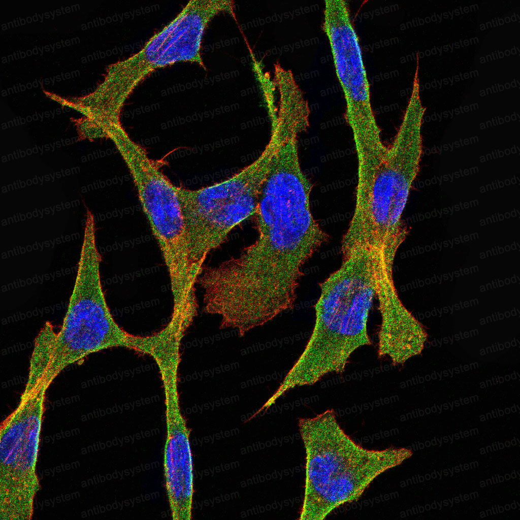Валидация IF - AntibodySystem RHD53604 (654)