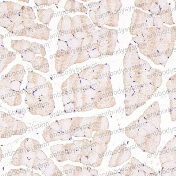 Валидация AntibodySystem RHF12201 (2464)