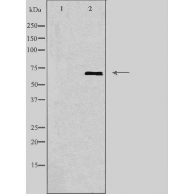 Валидация Affinity DF3598 - 14563