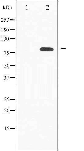 Валидация Affinity AF6015 - 3202