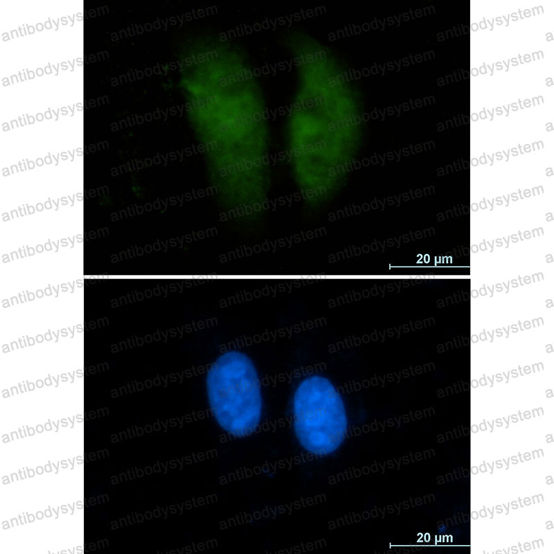 Валидация IF - AntibodySystem RHC39301