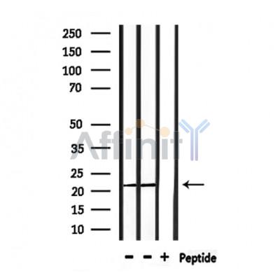 Валидация Affinity DF6691 - 18191