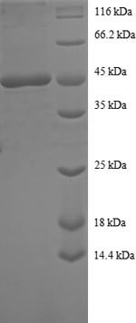 SDS-PAGE